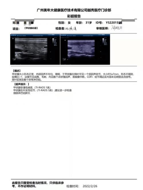 VPRADS1类B超,能否进行检测?插图 VPRADS1类B超,能否进行检测?插图
